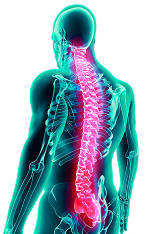anatomic representation of a painful spine